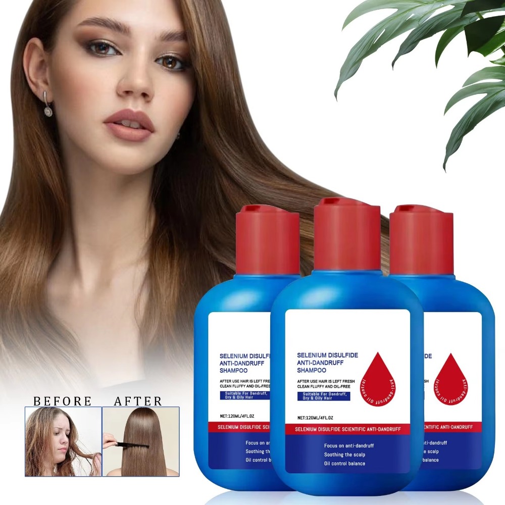 Hair Care Dandruff - Nuevo Champú Nipori de 120 ml,