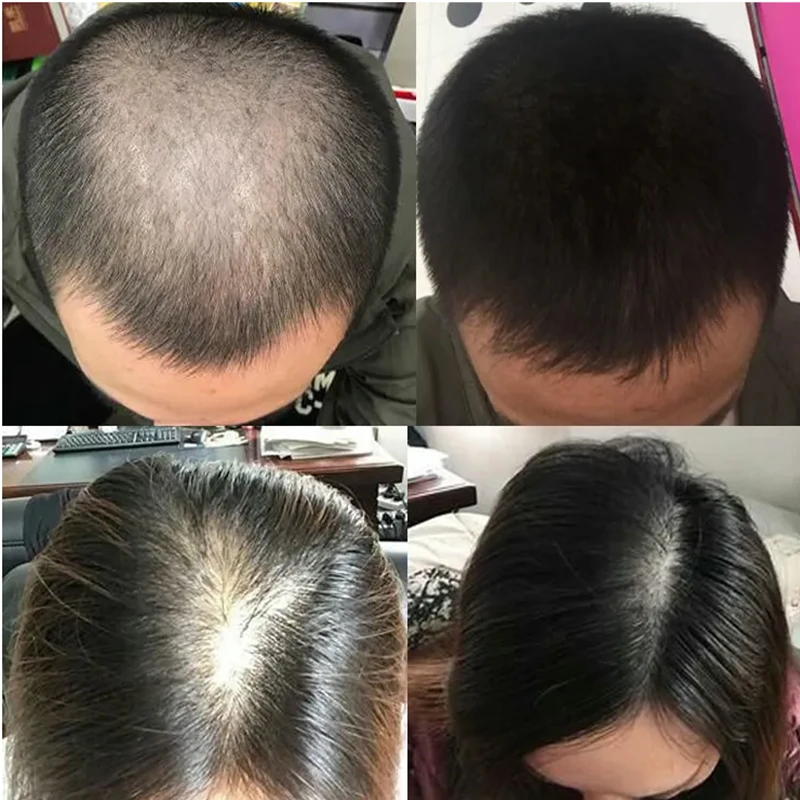 Líquido para el Crecimiento de - Hair Care Or Haircare reseña y precio