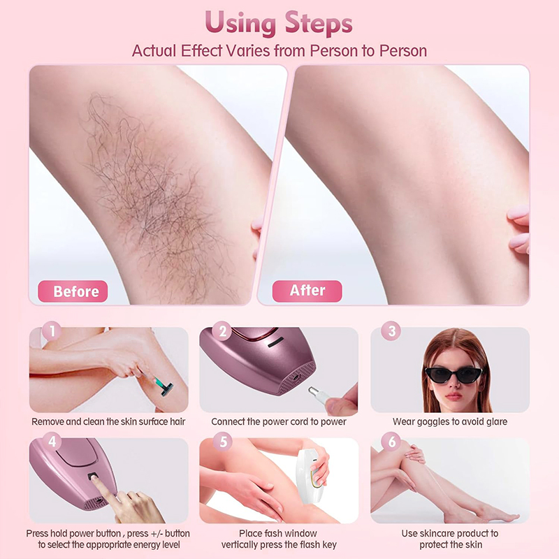 Depiladora láser IPL, máquina  - Hair Care Or Haircare reseña y precio