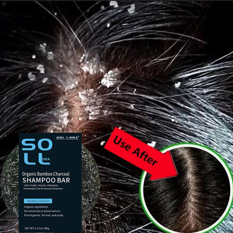 Jabón para tratamiento del cab - Hair Care Dandruff reseña y precio